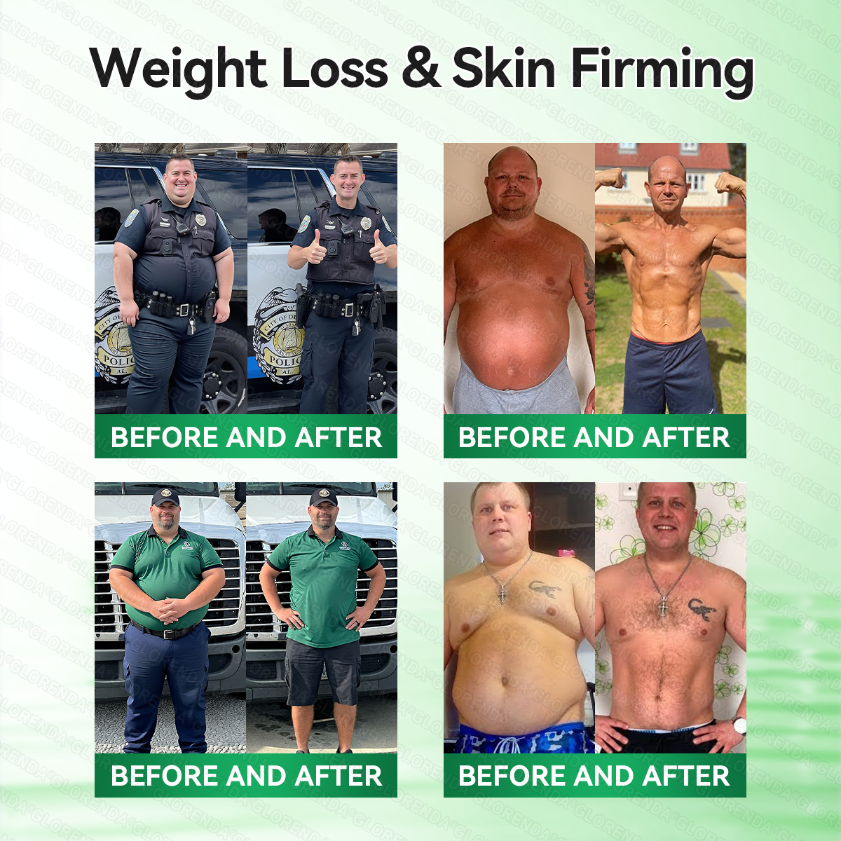 🇨🇦🍁𝐂𝐚𝐫𝐞𝐔𝐩𝐥𝐢𝐟𝐭® 𝙈𝒐𝒓𝒊𝒏𝒈𝗮 · 𝗕𝗲𝗿𝗯𝐞𝐫𝐢𝐧𝙚 × 𝙉𝑨𝑫+ 𝟏𝟎-𝙞𝙣-𝟏 𝘼𝒅𝒗𝒂𝒏𝒄𝒆𝐝 𝐍𝐚𝐧𝙤 𝙈𝙞𝙘𝙧𝙤𝙣𝒆𝒆𝒅𝒍𝐞 𝐏𝐚𝐭𝙘𝙝(𝐉𝐮𝐬𝐭 𝐨𝐧𝐜𝐞 𝐚 𝐝𝐚𝐲, 𝐯𝐢𝐬𝐢𝐛𝐥𝐞 𝐜𝐡𝐚𝐧𝐠𝐞𝐬 𝐢𝐧 𝟕 𝐝𝐚𝐲𝐬） ✅ 𝐅𝐨𝐫 𝐨𝐛𝐞𝐬𝐢𝐭𝐲, 🅛🅞🅞🅢🅔 🅢🅚🅘🅝,𝐝𝐢𝐚𝐛𝐞𝐭𝐞𝐬, 𝐬𝐥𝐞𝐞𝐩 𝐚𝐩𝐧𝐞𝐚, 𝐣𝐨𝐢𝐧𝐭 𝐢𝐬𝐬𝐮𝐞𝐬, 𝐚𝐧𝐝 𝐦𝐨𝐫𝐞💯💯