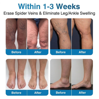 🇨🇦🏆✅️🏃𝗛𝗶𝘀𝗸𝗶𝗻® VeinRepair Microneedle Patch Roll⚡Instant Relief, Long-Term Results