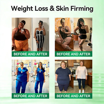 𝑶𝒇𝒇𝒊𝒄𝒊𝒂𝒍 𝑺𝒕𝒐𝒓𝒆|🍀🍀𝐂𝐚𝐫𝐞𝐔𝐩𝐥𝐢𝐟𝐭® 𝙈𝒐𝒓𝒊𝒏𝒈𝗮 · 𝗕𝗲𝗿𝗯𝐞𝐫𝐢𝐧𝙚 × 𝙉𝑨𝑫+ 𝟏𝟎-𝙞𝙣-𝟏 𝘼𝒅𝒗𝒂𝒏𝒄𝒆𝐝 𝐍𝐚𝐧𝙤 𝙈𝙞𝙘𝙧𝙤𝙣𝒆𝒆𝒅𝒍𝐞 𝐏𝐚𝐭𝙘𝙝(𝐉𝐮𝐬𝐭 𝐨𝐧𝐜𝐞 𝐚 𝐝𝐚𝐲, 𝐯𝐢𝐬𝐢𝐛𝐥𝐞 𝐜𝐡𝐚𝐧𝐠𝐞𝐬 𝐢𝐧 𝟕 𝐝𝐚𝐲𝐬） ✅ 𝐅𝐨𝐫 𝐨𝐛𝐞𝐬𝐢𝐭𝐲, 🅛🅞🅞🅢🅔 🅢🅚🅘🅝,𝐝𝐢𝐚𝐛𝐞𝐭𝐞𝐬, 𝐬𝐥𝐞𝐞𝐩 𝐚𝐩𝐧𝐞𝐚, 𝐣𝐨𝐢𝐧𝐭 𝐢𝐬𝐬𝐮𝐞𝐬, 𝐚𝐧𝐝 𝐦𝐨𝐫𝐞💯💯
