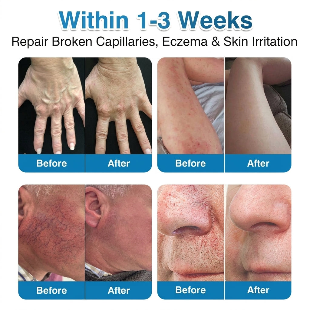 🇨🇦🏆✅️🏃𝗛𝗶𝘀𝗸𝗶𝗻® VeinRepair Microneedle Patch Roll⚡Instant Relief, Long-Term Results